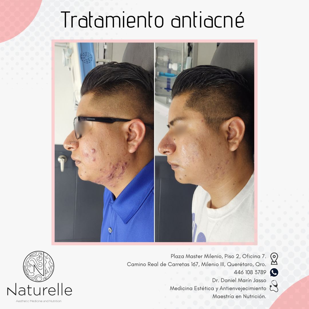 Daniel Marín Jasso-8