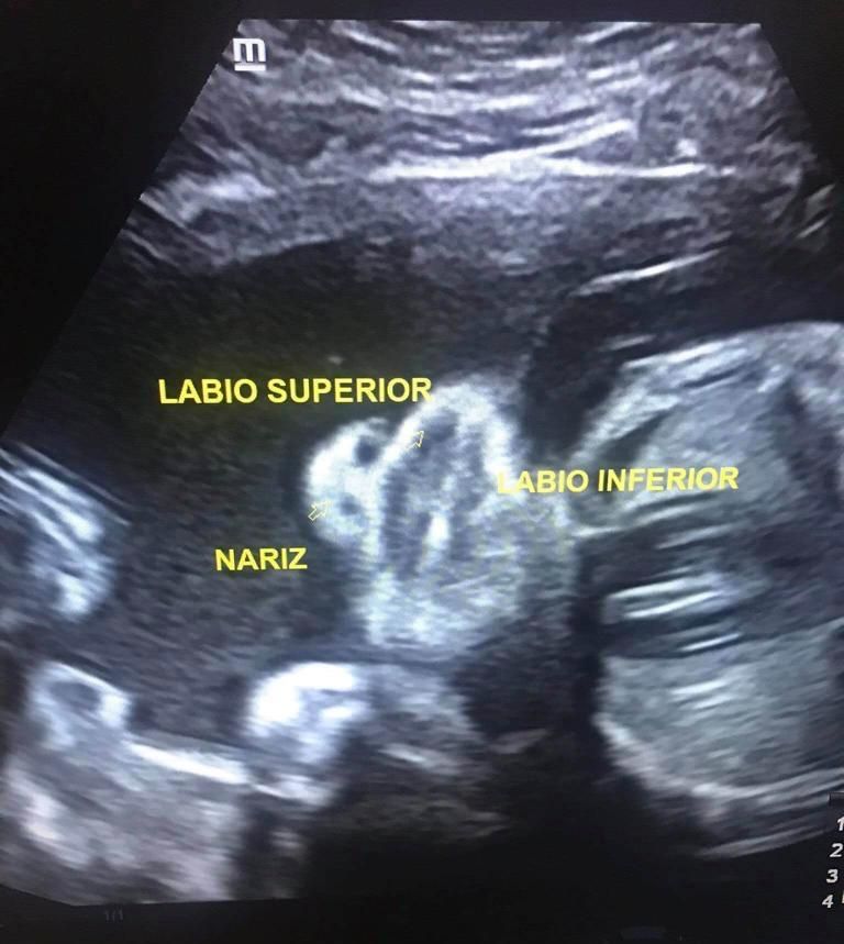 Luz Rodríguez López-0