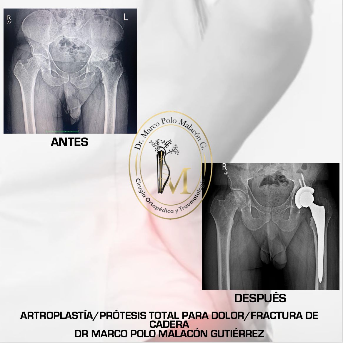 Marco Polo Malacón Gutiérrez-11