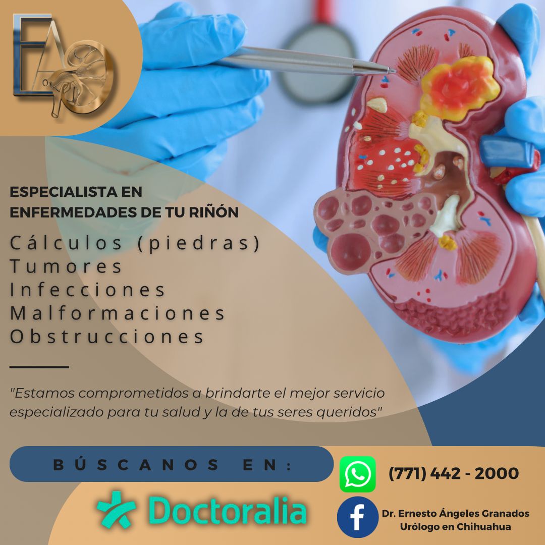 Ernesto Ángeles Granados-1