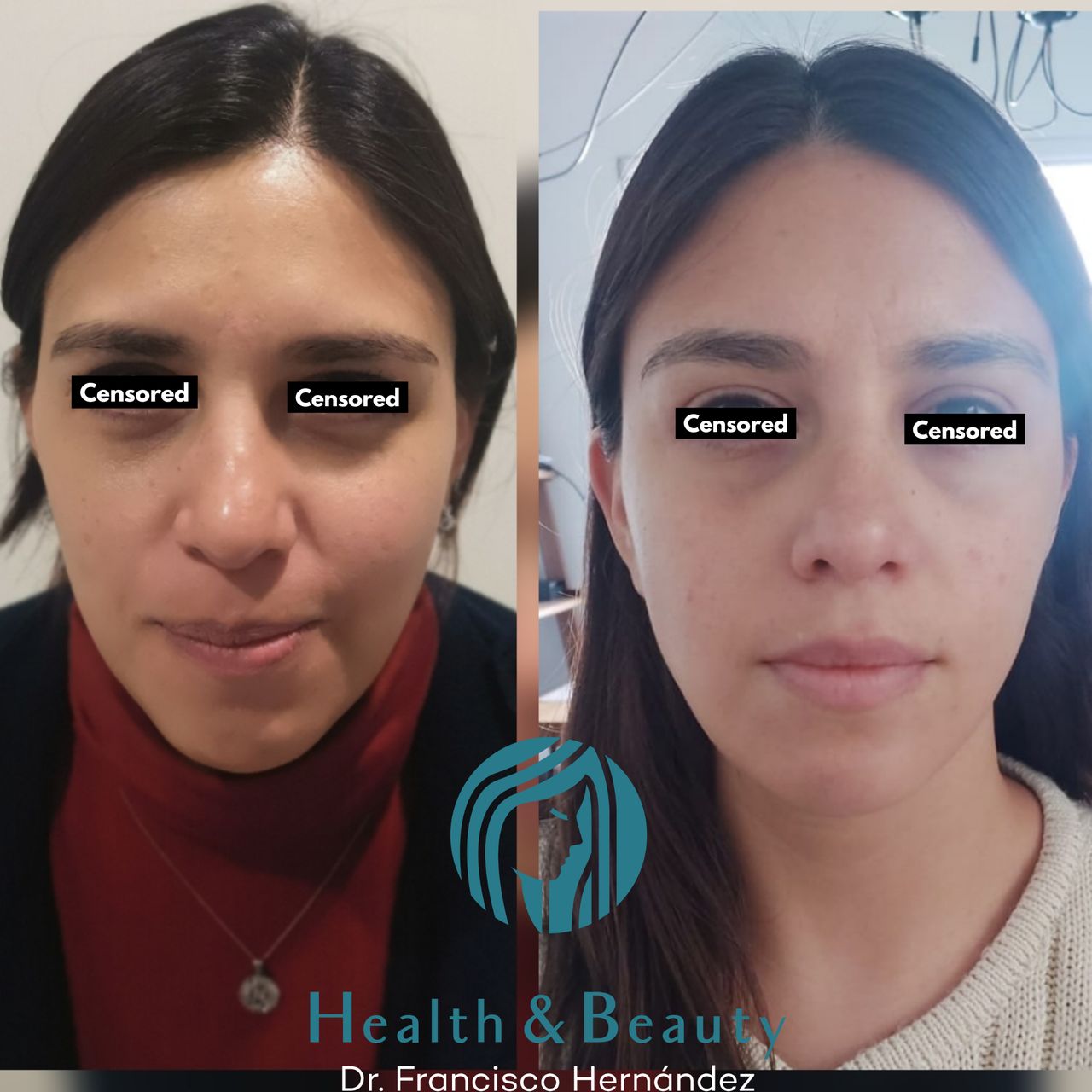 Francisco Hernández Gómez Crespo-176