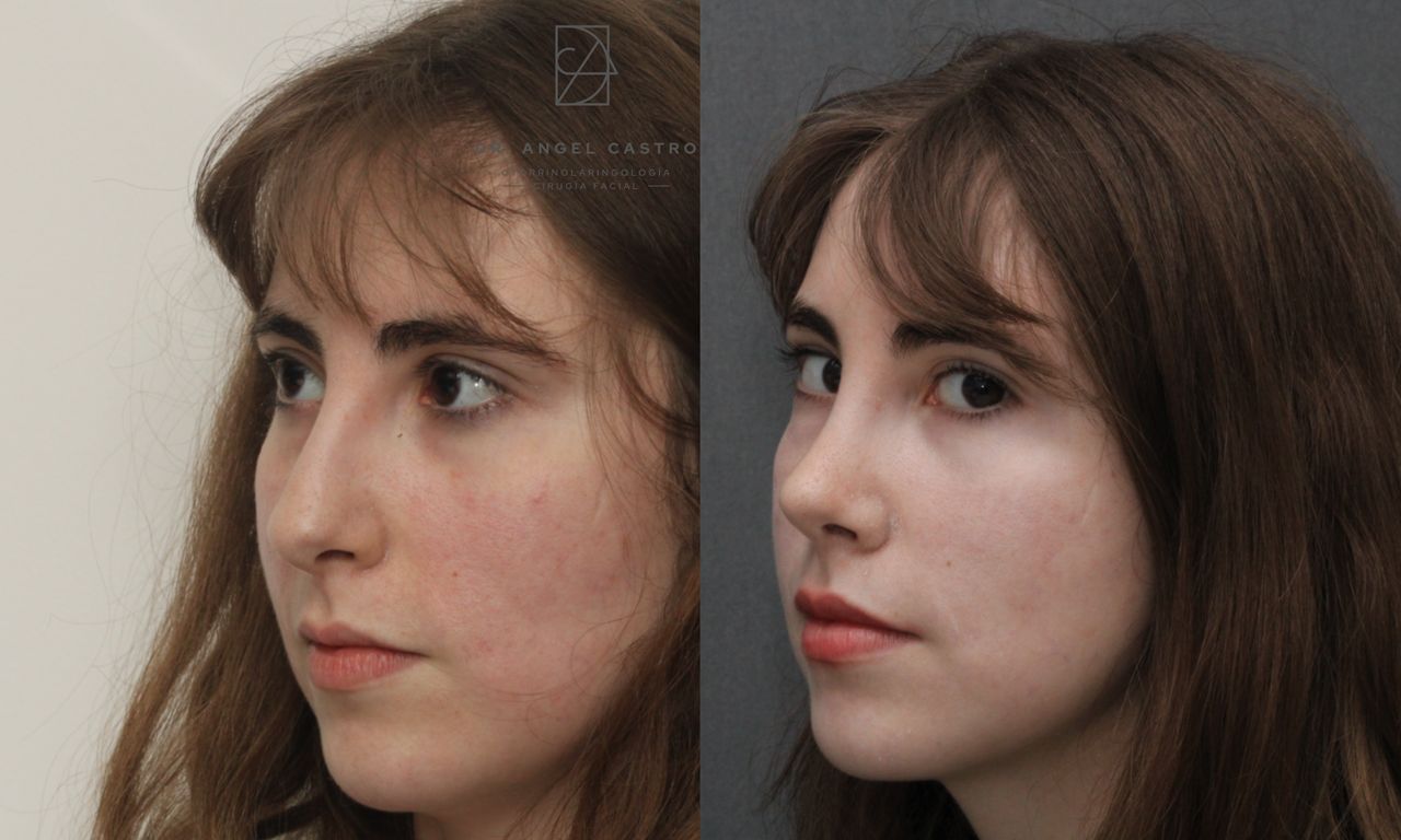 Angel Castro Urquizo-172