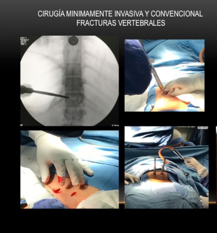 Griselda Collado Arce-19