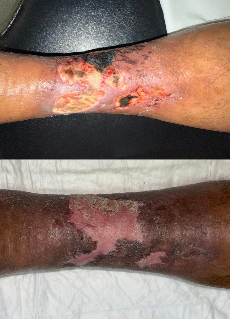 Jhonatan López González-67