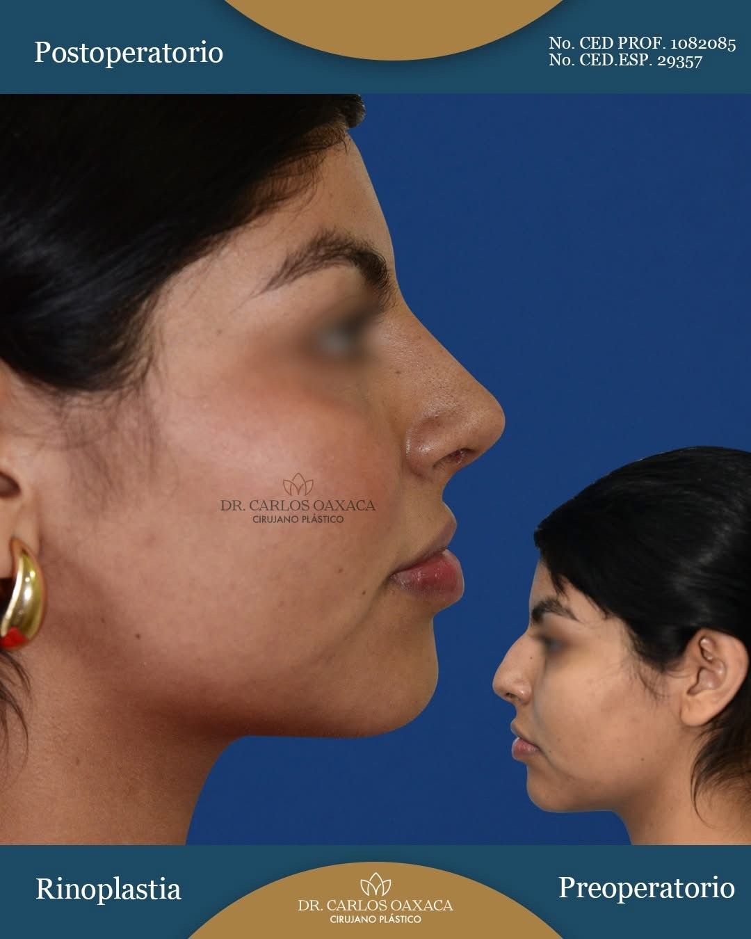 Carlos Guillermo Oaxaca Escobar-7