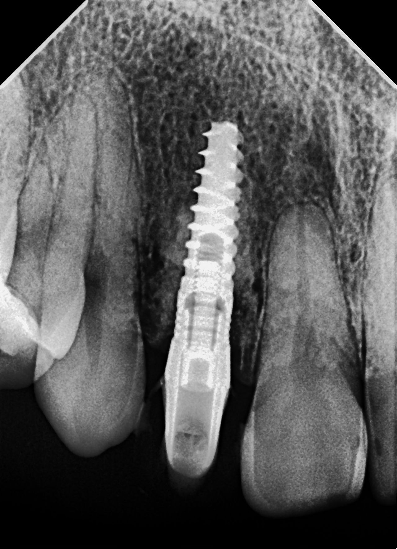 Hugo Enrique Aguilar Lamas-92