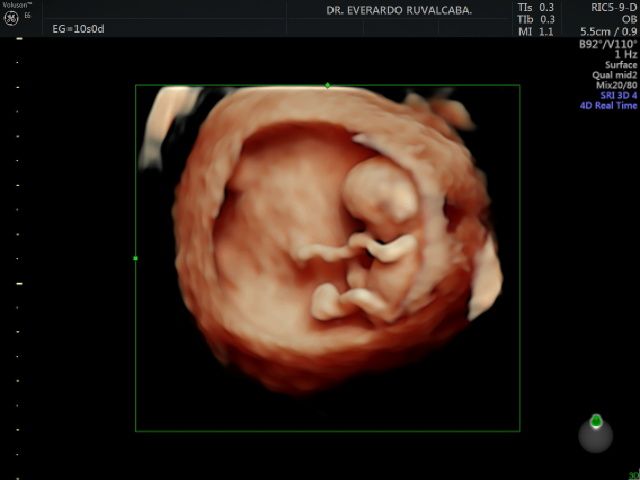 Everardo Ruvalcaba Rivera-5