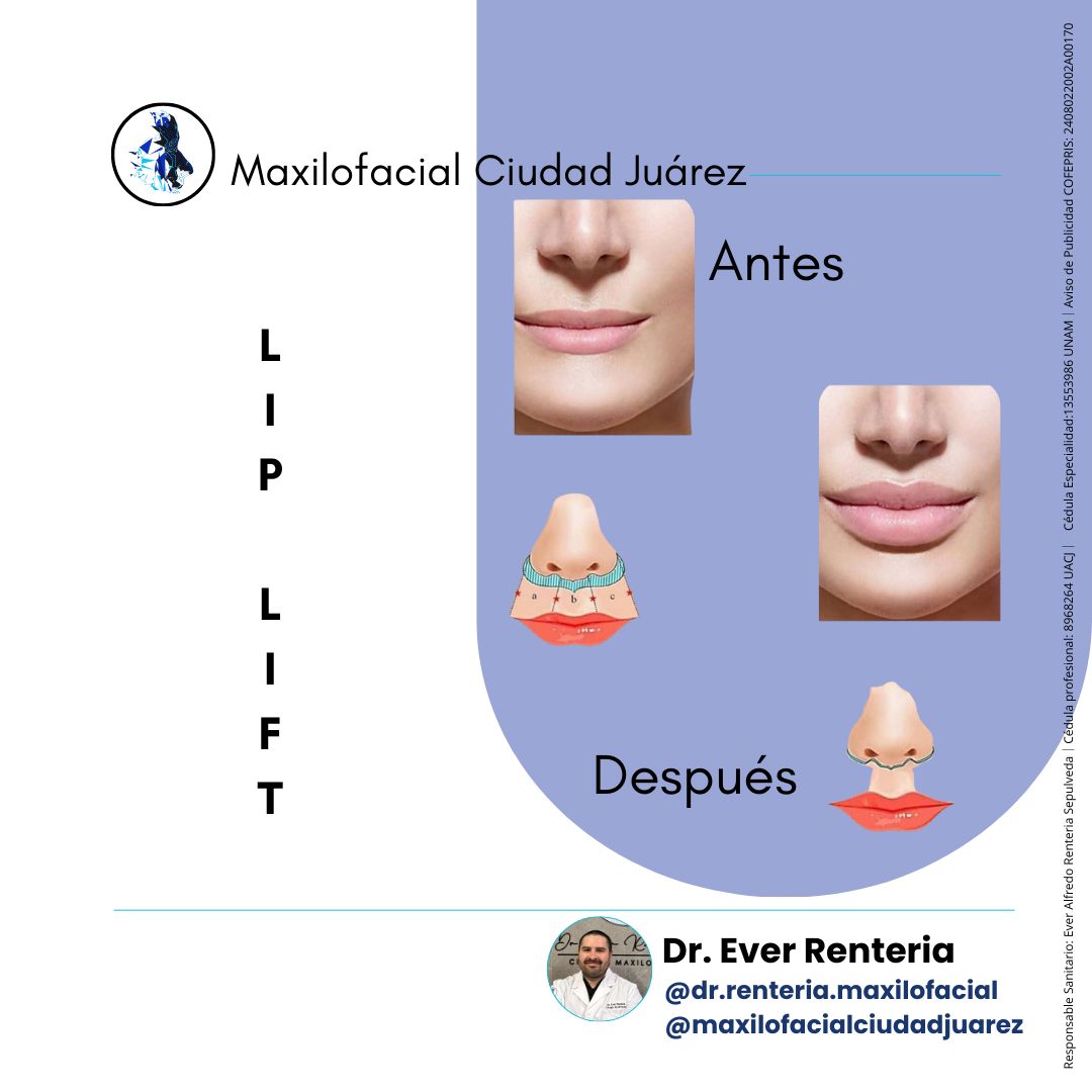 Ever Renteria Sepulveda-4