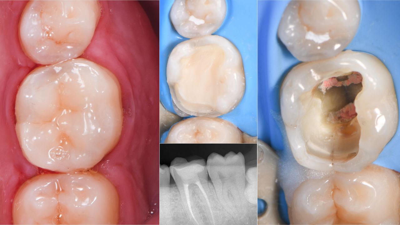 Ricardo López Lemus-13