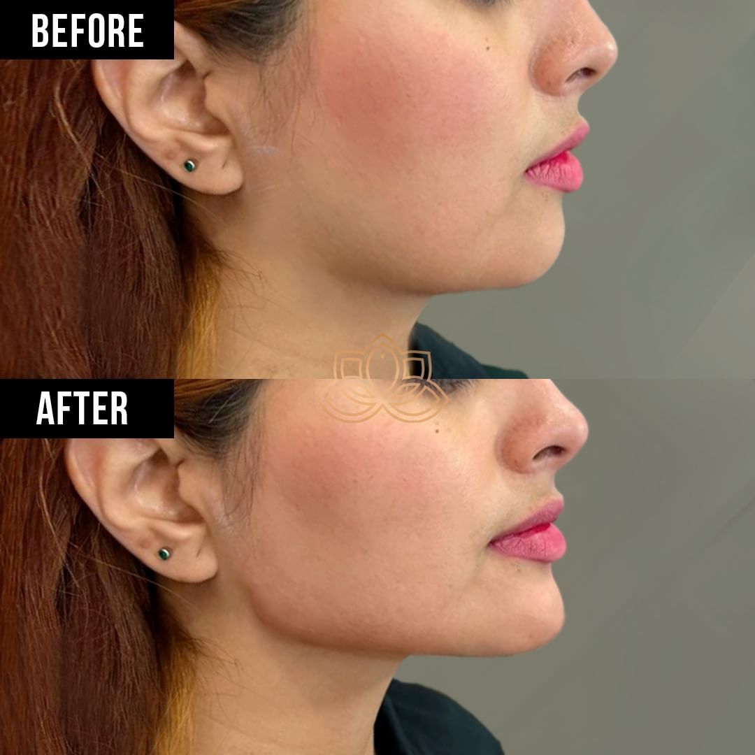 Dario Alfredo Cadenas Ruvalcaba-5