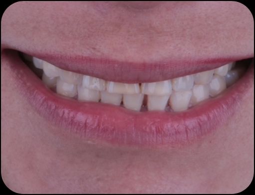 Edgardo Caballero Dávila-25