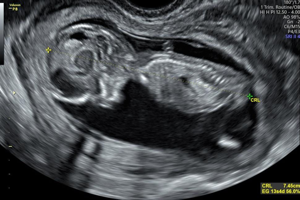 Dulce Anabel Jarquin Arango-35