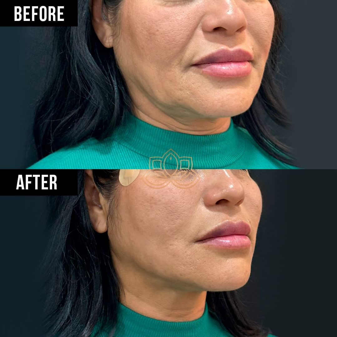 Dario Alfredo Cadenas Ruvalcaba-3