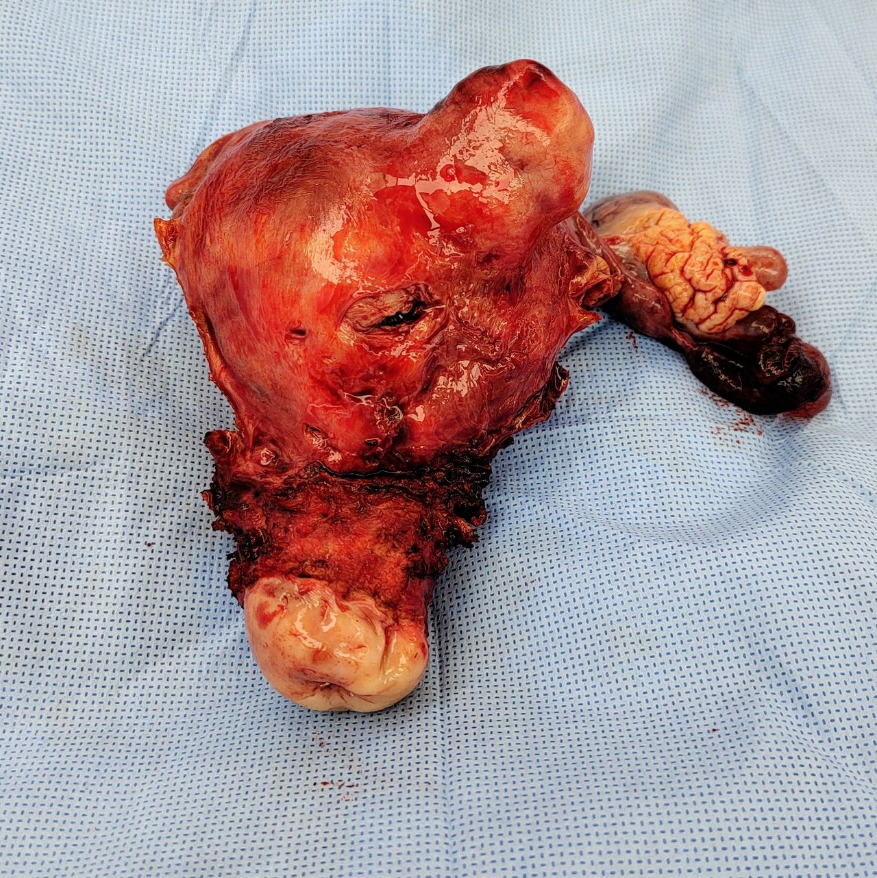 Luis Edmundo Hernández Vivar-3