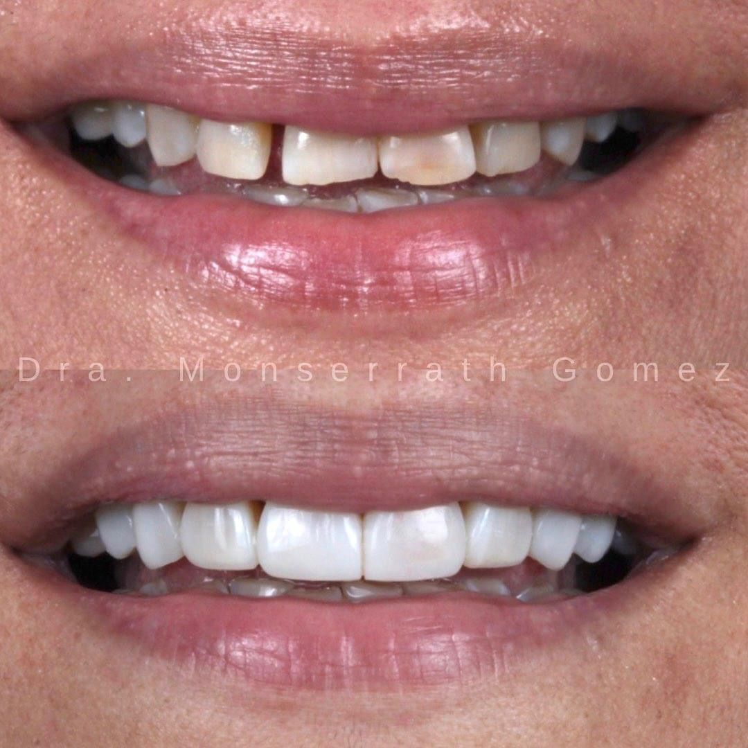 Monserrath Gomez Mendez-2