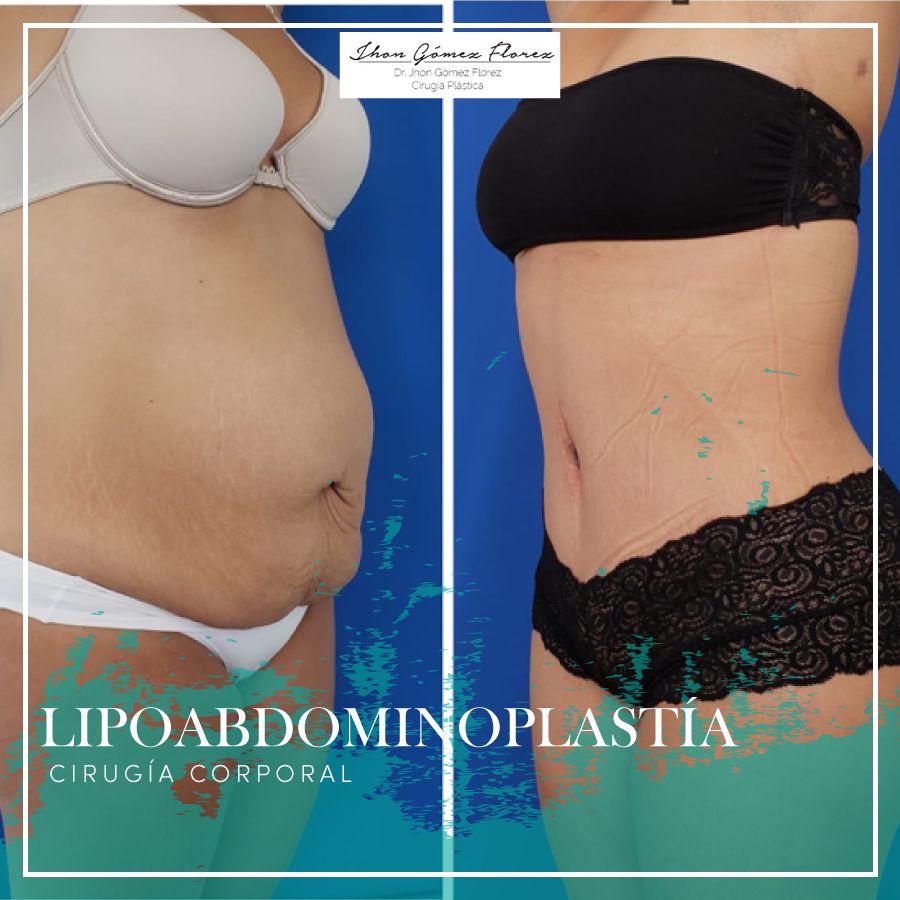 Jhon César Gómez Florez-55