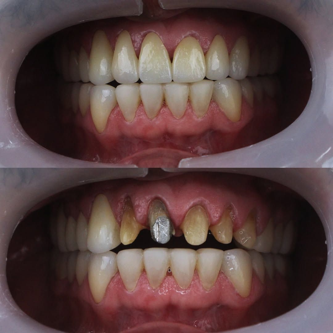 Alejandro Bates Souza-7