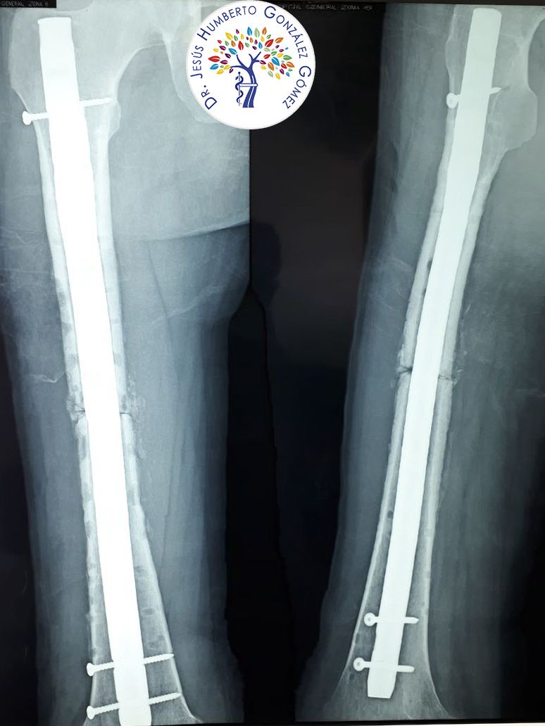 Jesús Humberto González Gómez-19