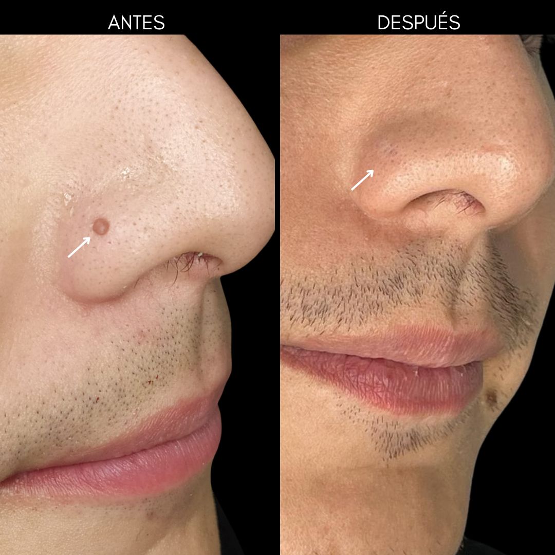 Consuelo Chapa Garza-9