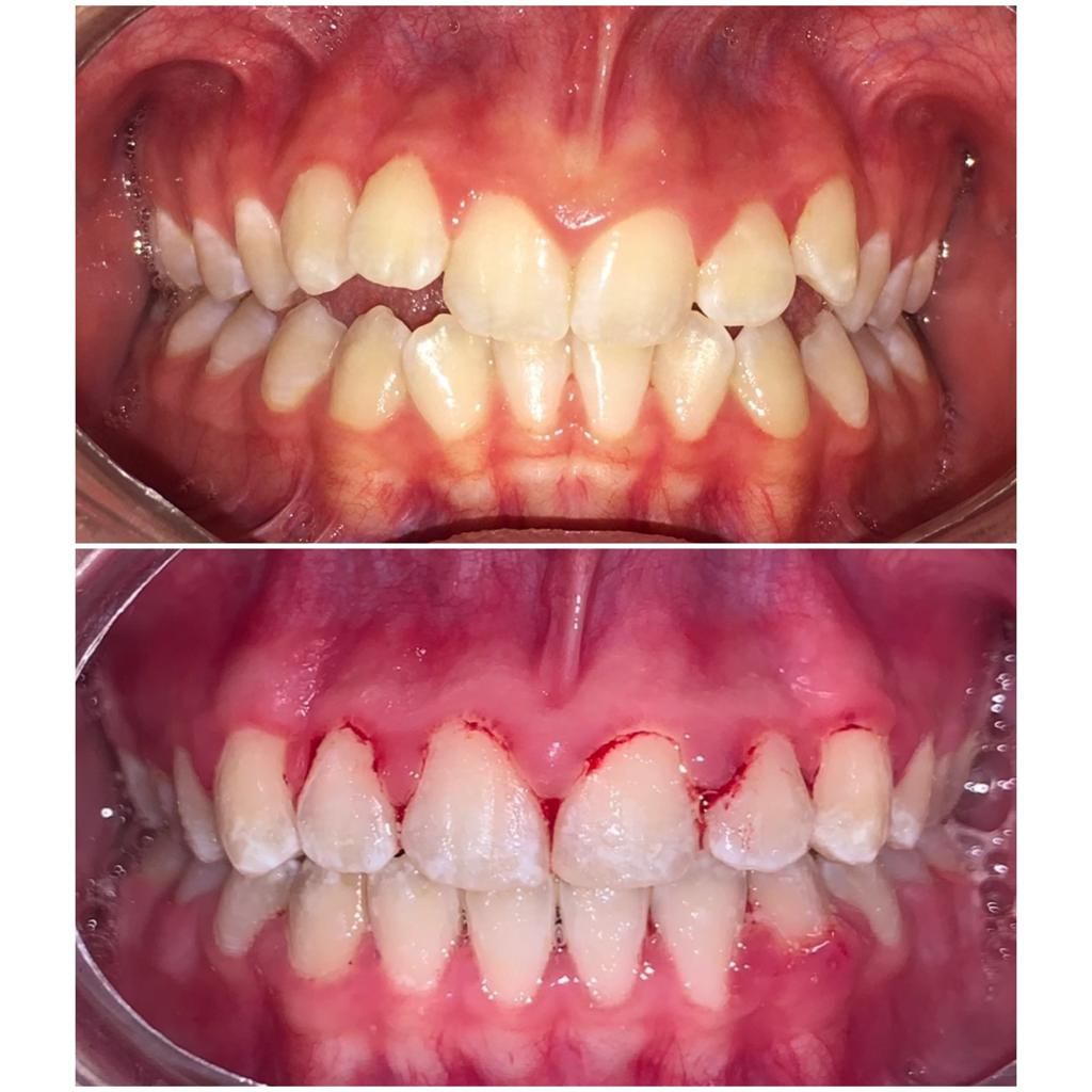 Blanca Elvia Soto Canales-9