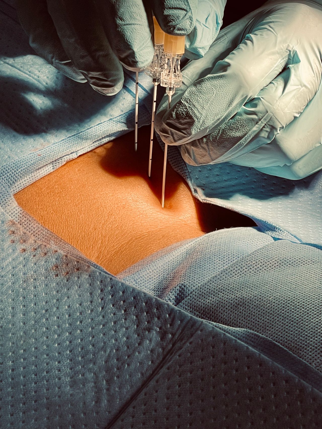 Juan Antonio Alvaro Heredia-6