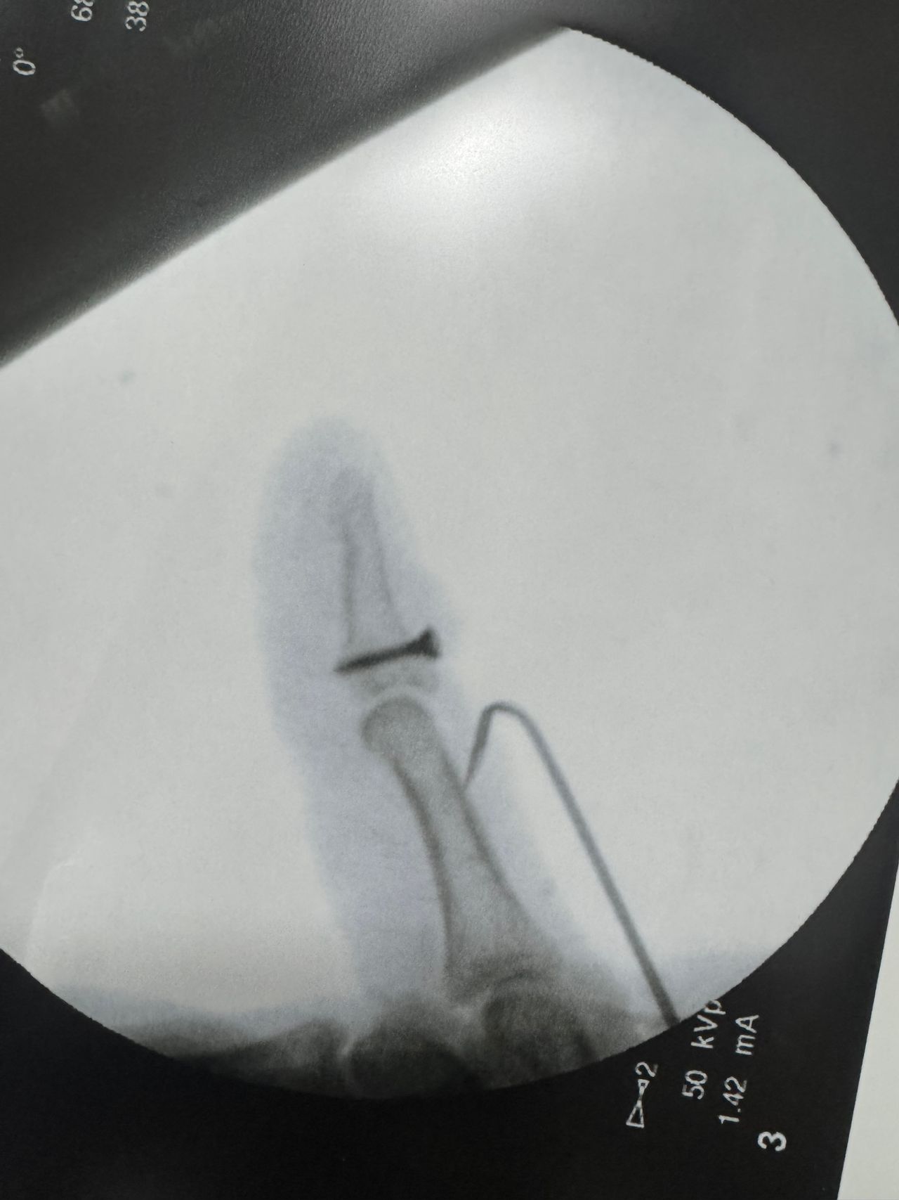 Carmen Yossaleth Briceño González-6