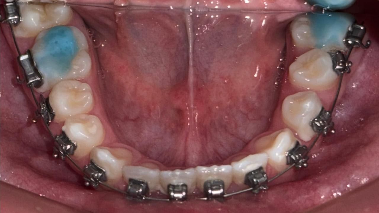 Miguel Angel Garita Cruz-10