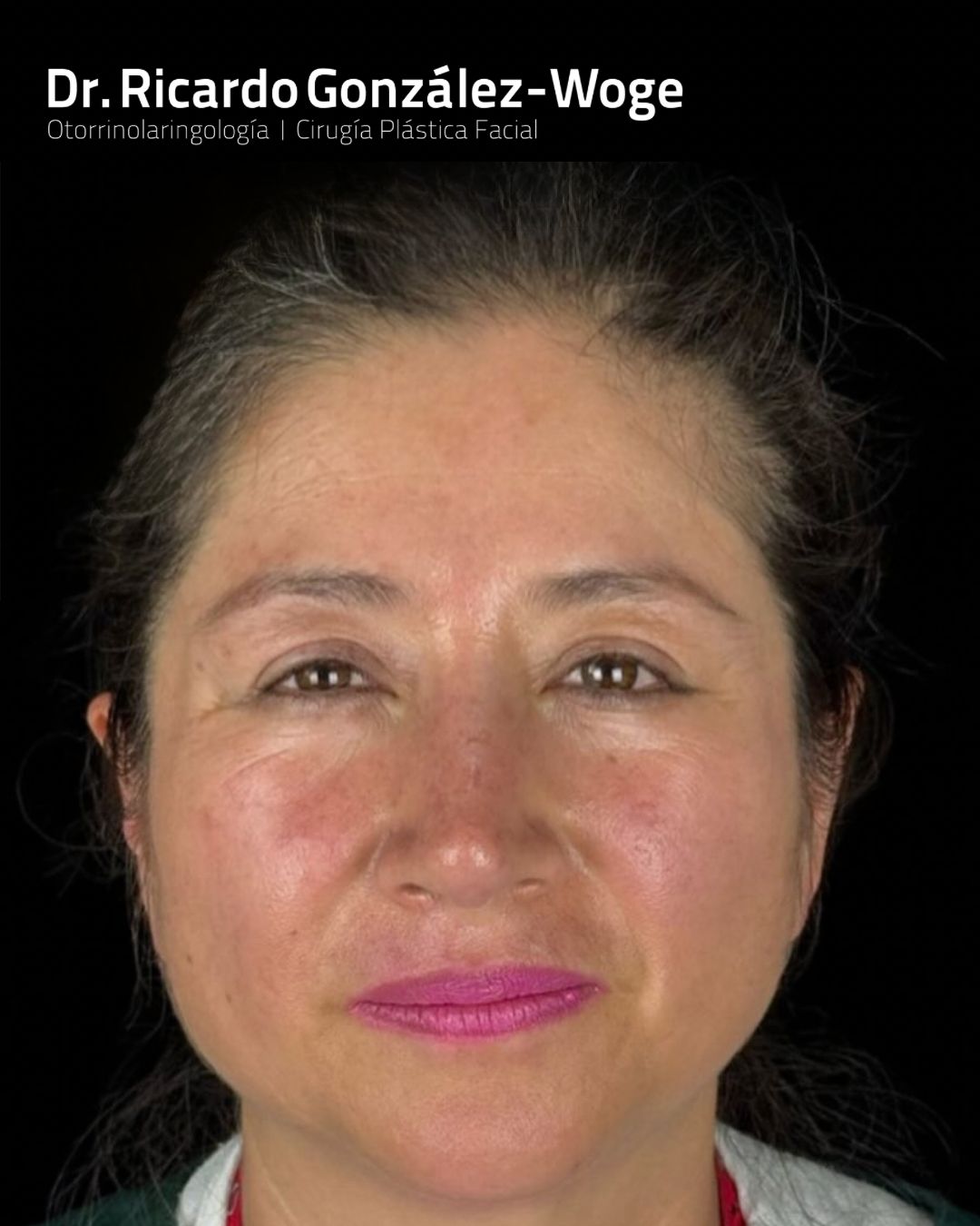 Ricardo Gonzalez Woge-18