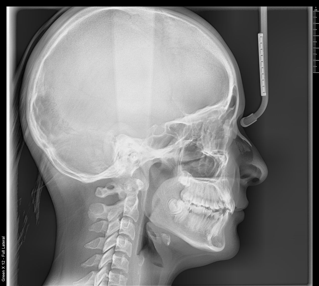 Francisco Alejandro Poblano Vázquez-2