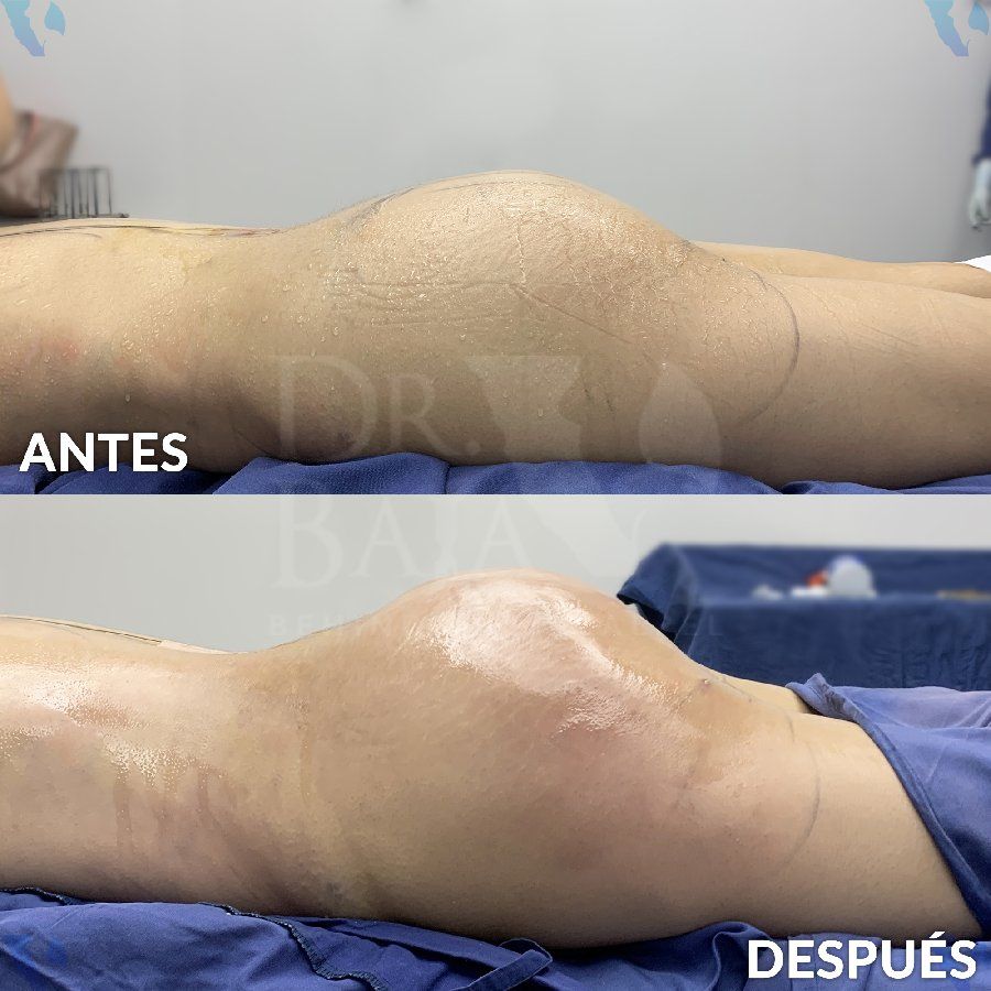 Renato Rodríguez Hirales-15