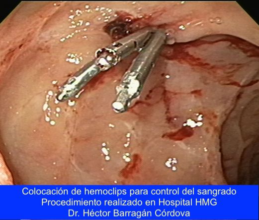 Héctor Hugo Barragán Córdova-1