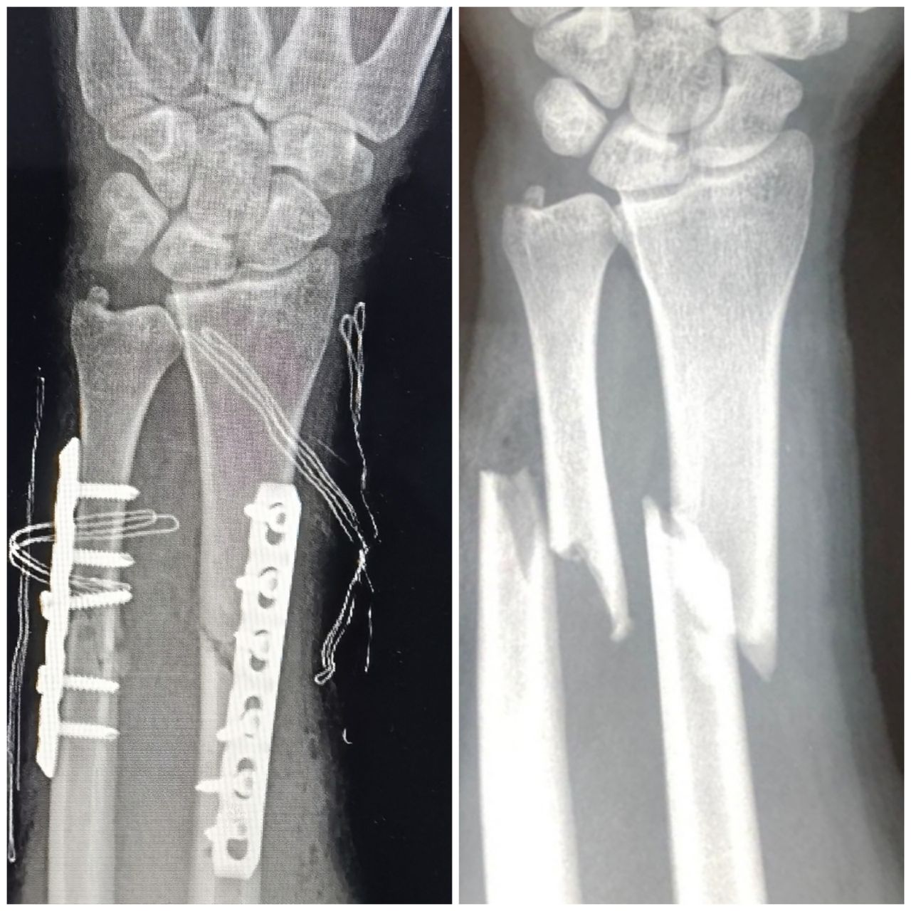 Gabriel De Leon Ochoa Lara-12