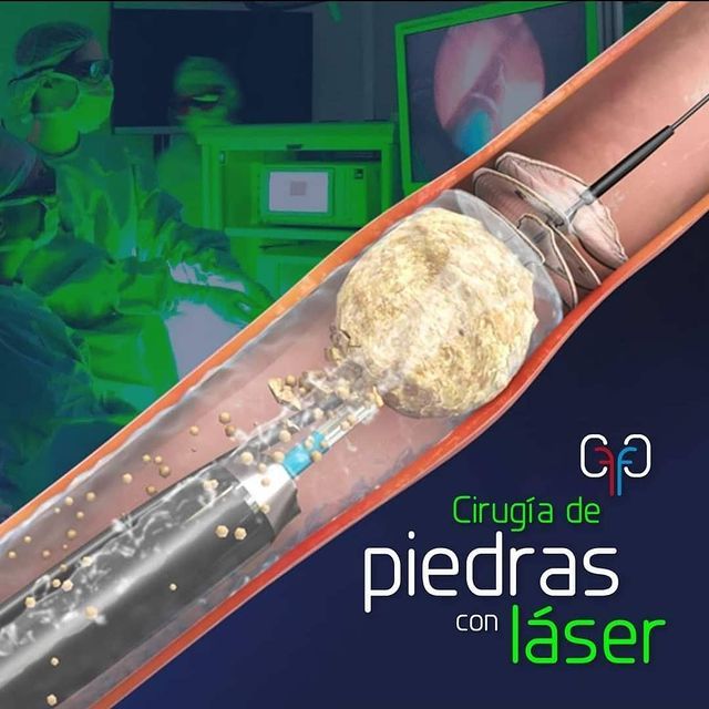 Orlando Frausto Valdes-15