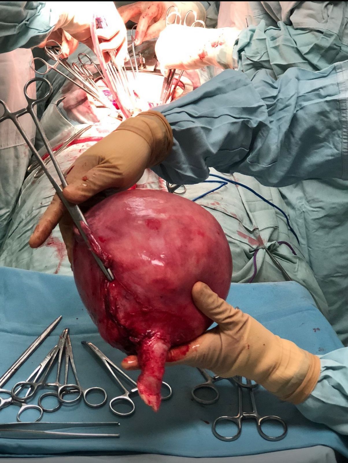 Juan Gabriel Nuño Nuño-6