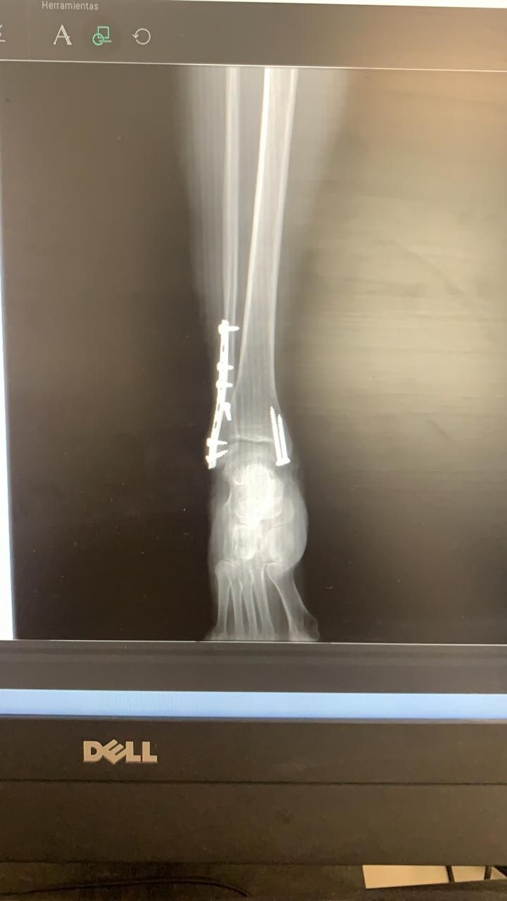 Jeftte Aaron Chacon Martinez-14