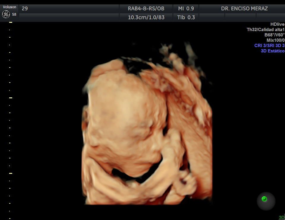 Juan Manuel Enciso Meraz-11