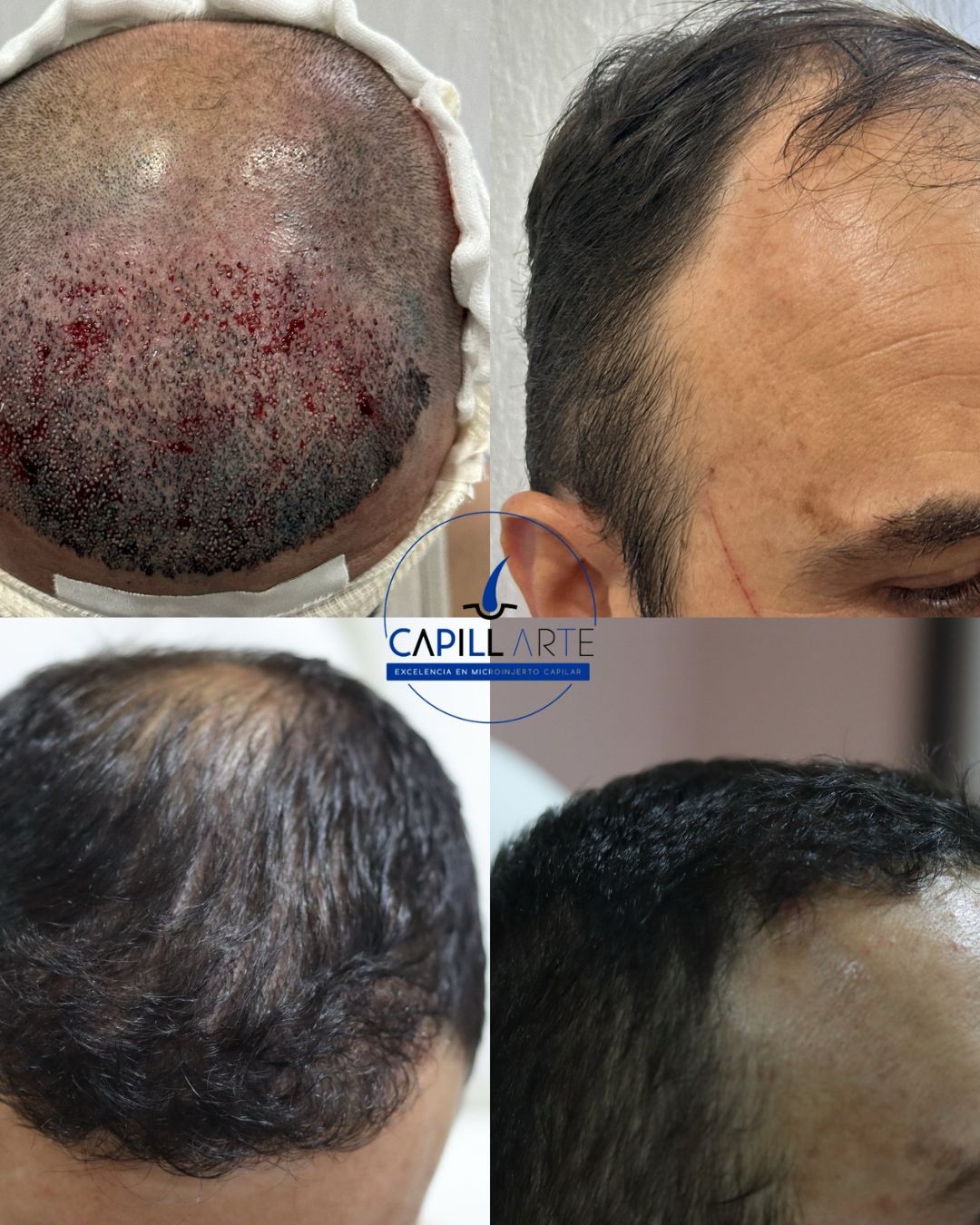 Adrian Hernandez Lopez-19