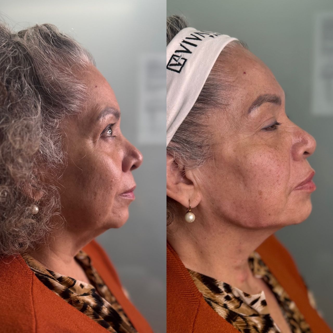 Anuar Hernández Flores-8