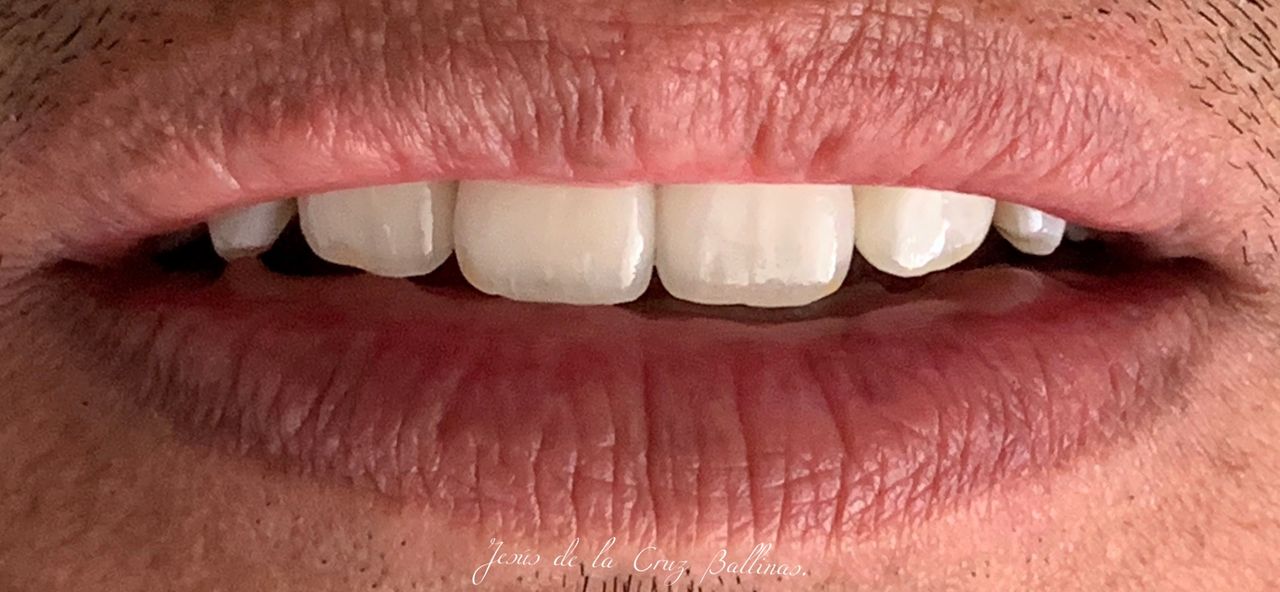 Jesus De La Cruz Ballinas-42