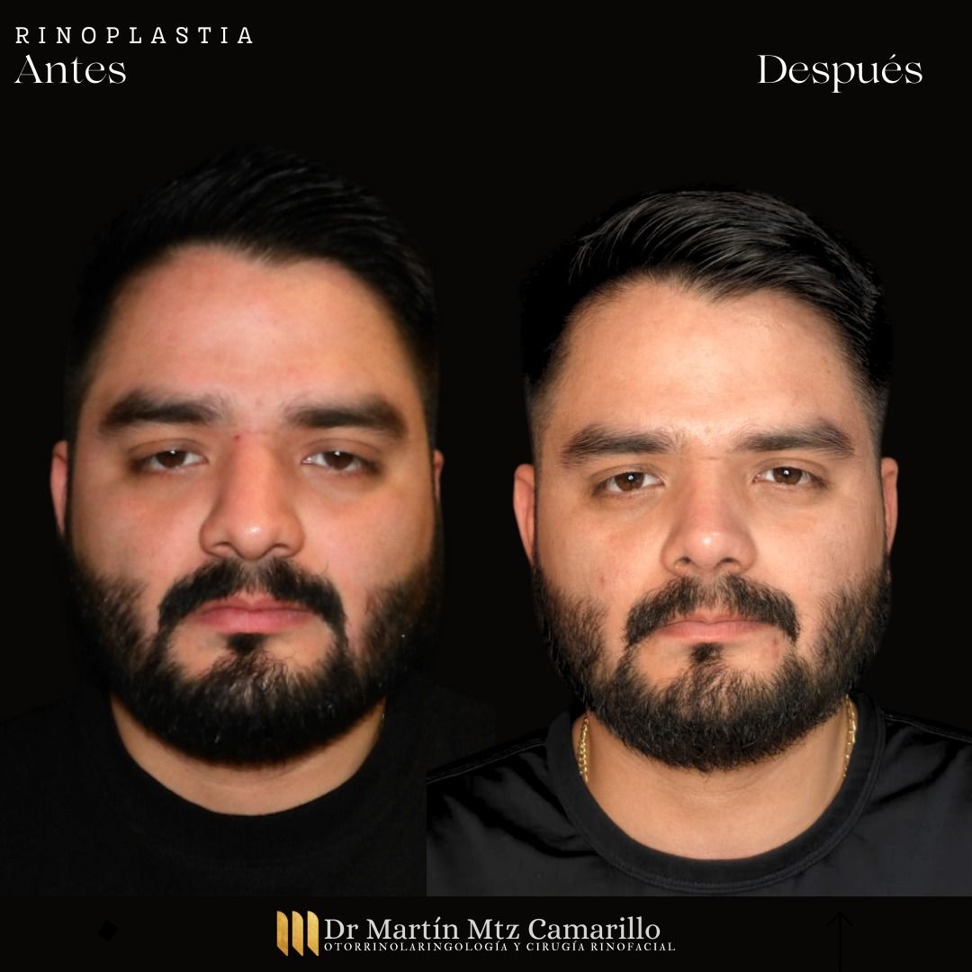 Martín Martínez Camarillo-22