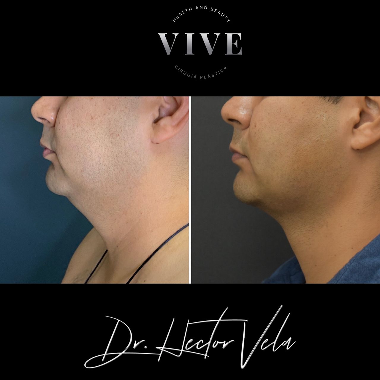 Héctor Eduardo Vela Cardona-197