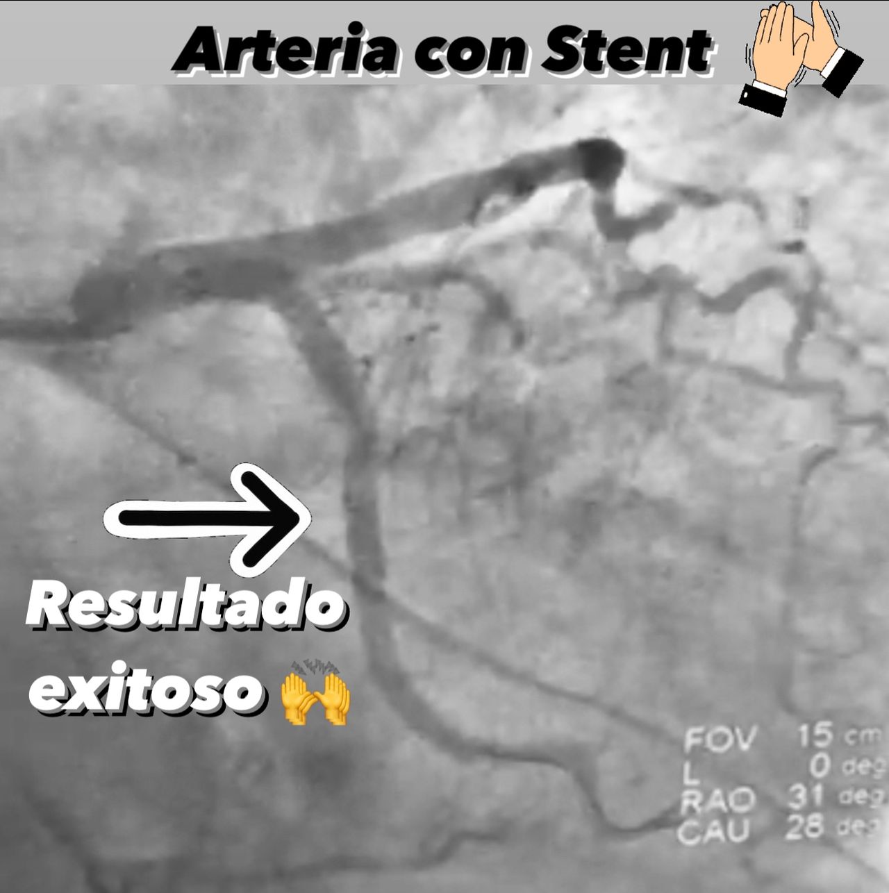 Abdón Ávila Chávez-36