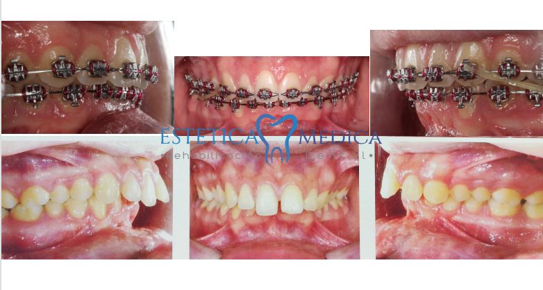 Bielmy Veronica Jonapa Peña-11