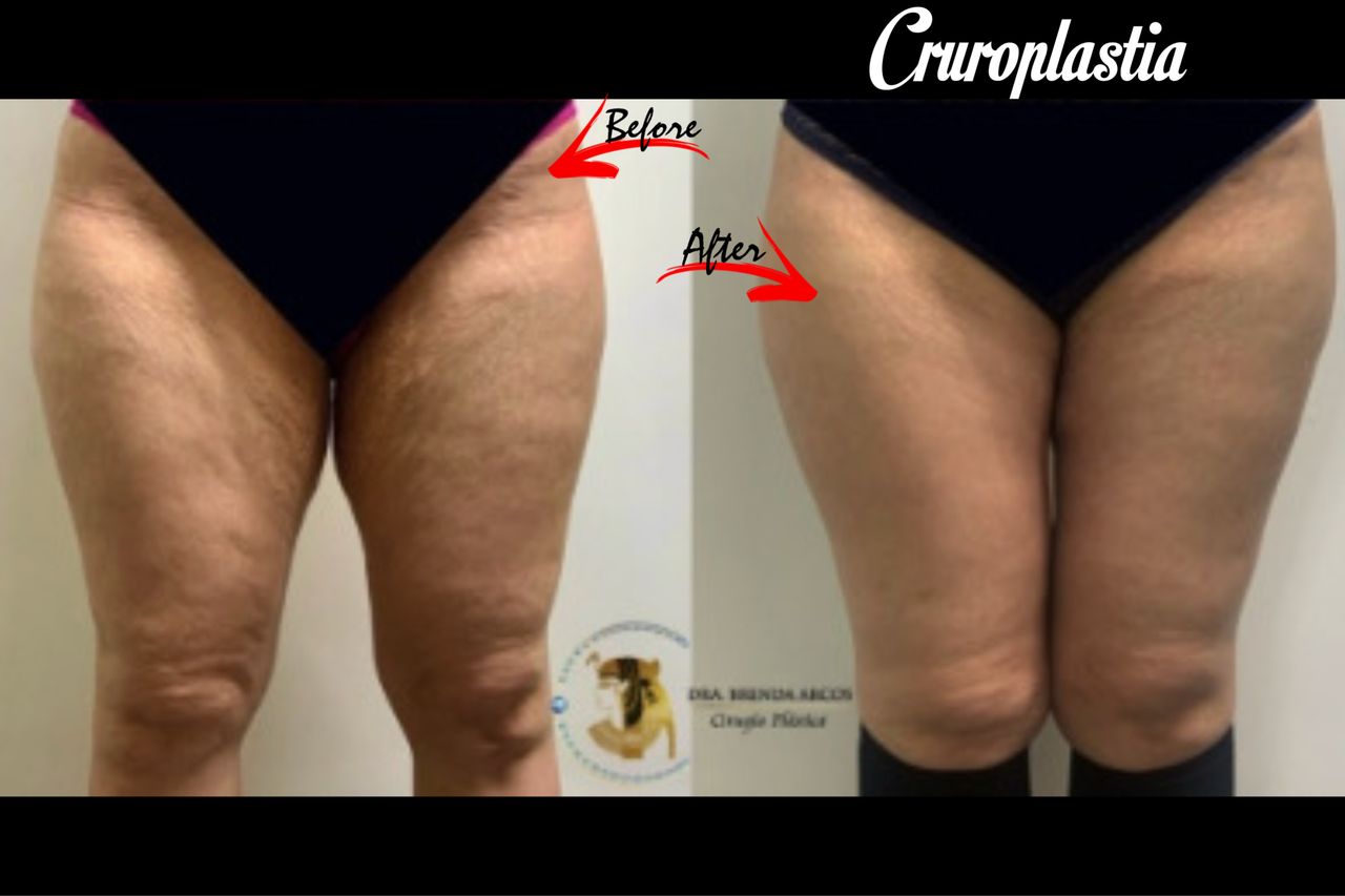 Brenda Arcos Vera-44