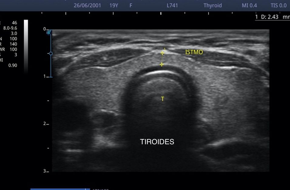 César Guerra Martínez-38