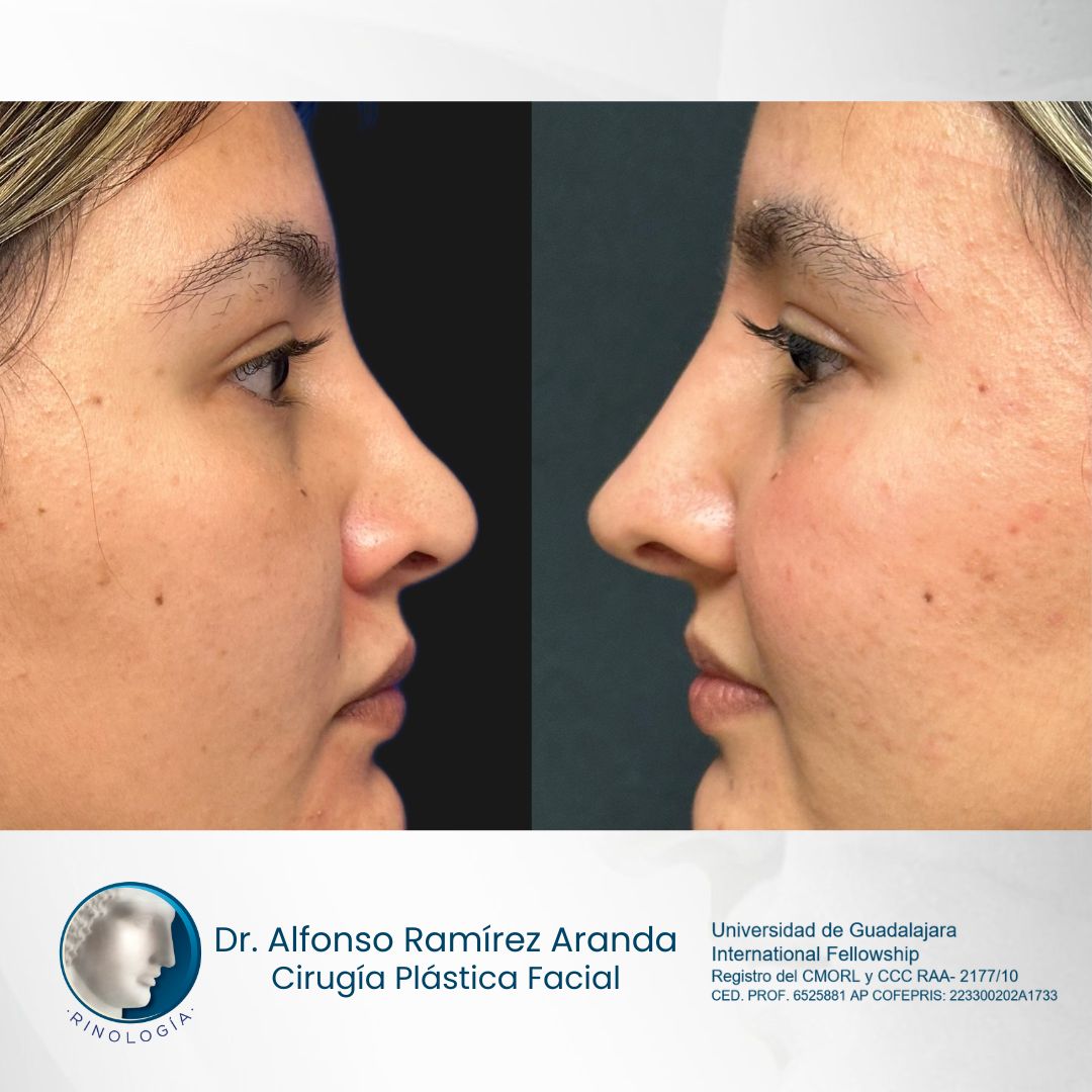 Alfonso Ramírez Aranda-42