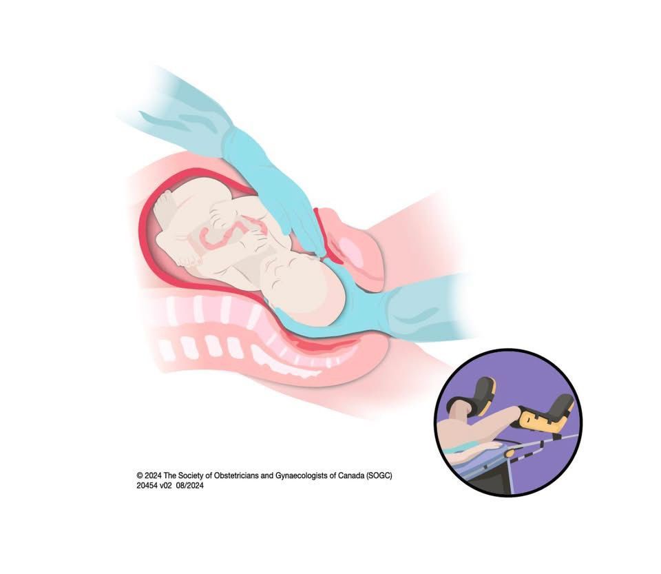 Guadalupe Muñoz Castro-118