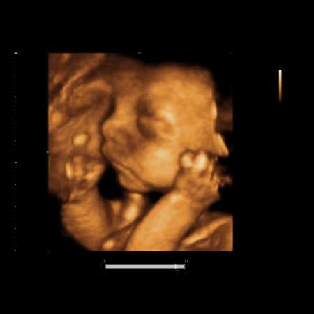 René Augusto Hernández Morales-4