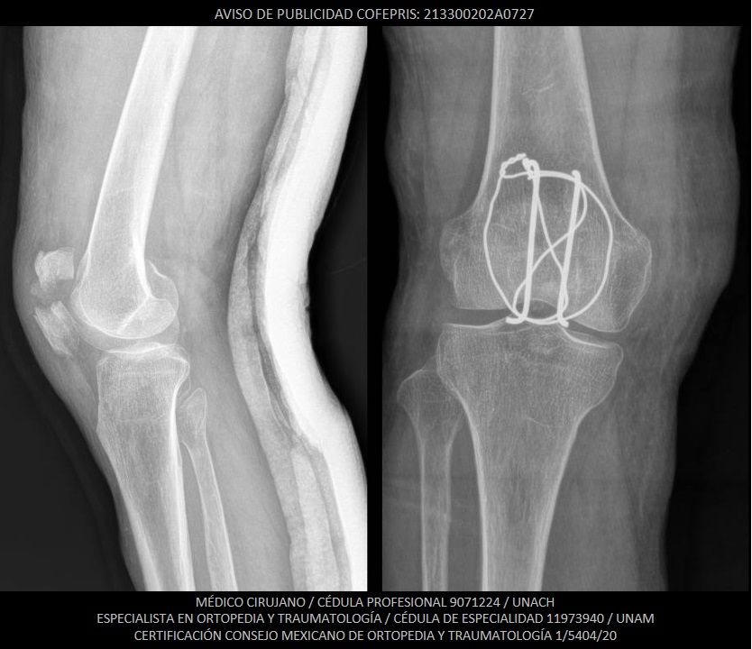 Luis Castañón Robles-8