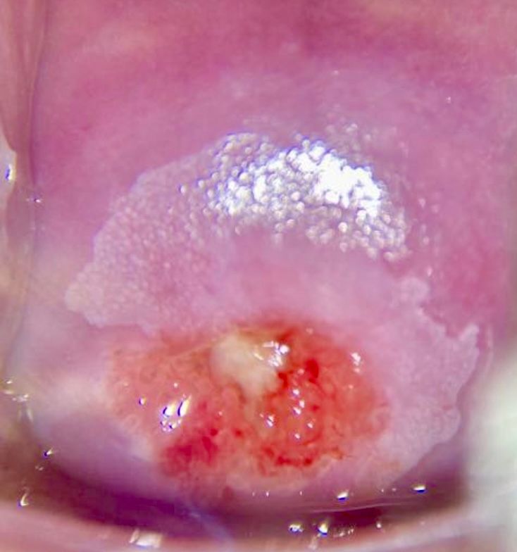 Marcos Javier Cano Luna-3